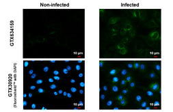Anti-Zika virus NS1 protein antibody [GT281] used in Immunocytochemistry/ Immunofluorescence (ICC/IF). GTX634159